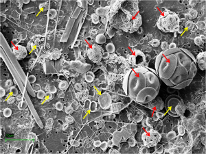 Diversity of coccolithophore size and shape (red arrows point to coccolithophores; yellow arrows point to individual coccoliths). Image courtesy of Alex Poulton.
